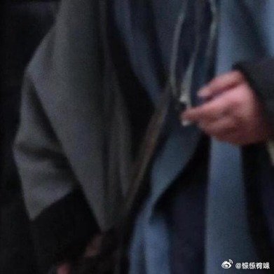 杨洋的手好肿我嘞个豆，这也太奇怪了吧！手莫名其妙肿起来了，到底是啥情况啊。 