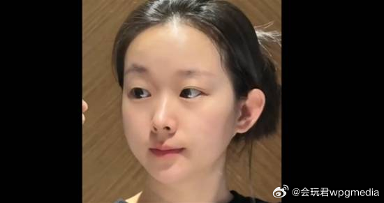 33岁女子长相幼态常被认为是小学生 本人回应：困扰20多年近日，一则关于