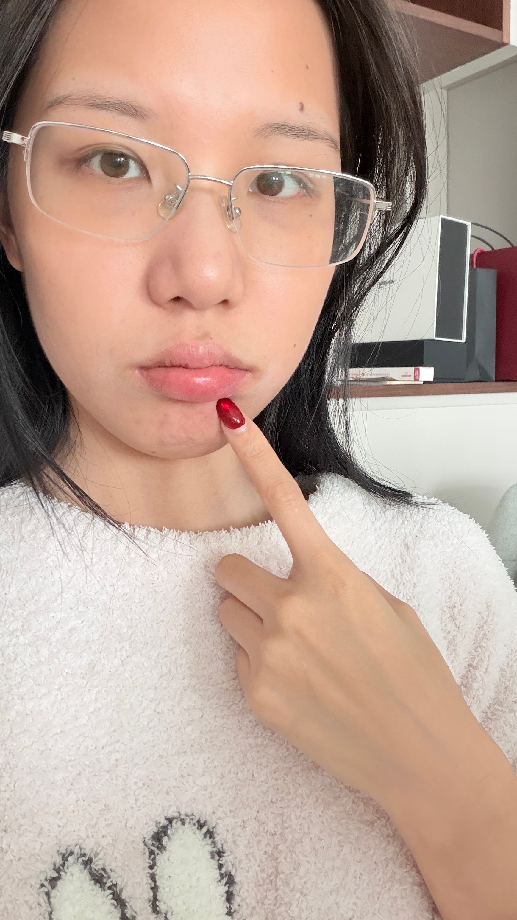 就昨晚熬了一会儿夜，一大早睡醒单纯疱疹驾到，3月能不能对我好一点？好痛苦啊，因为