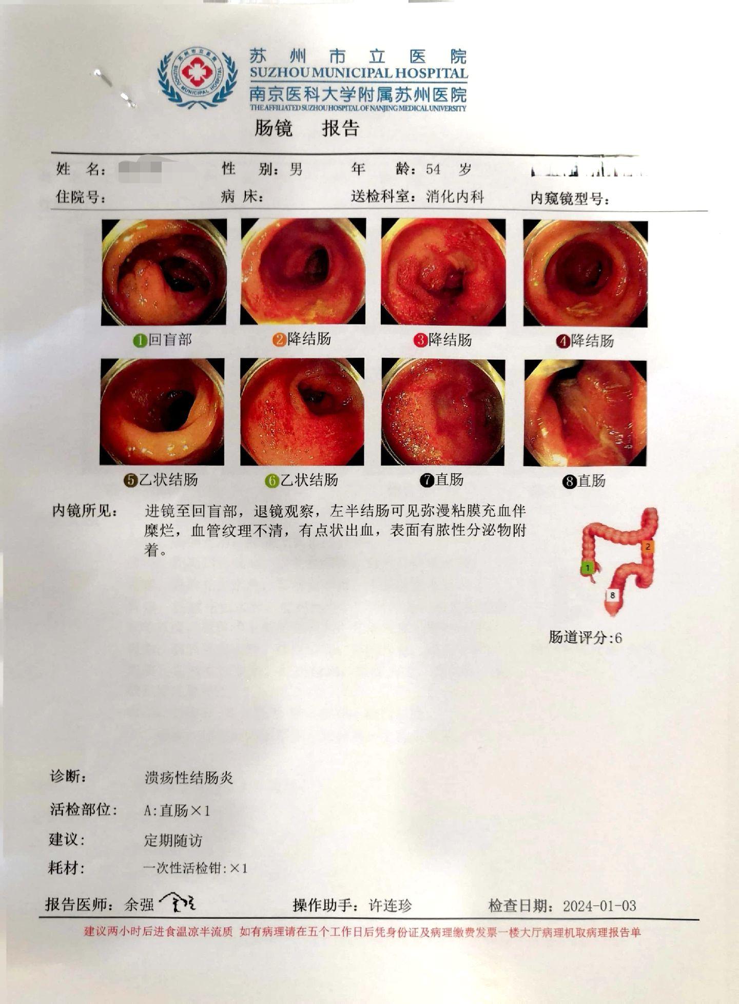 中药治疗溃疡性结肠炎难点在于剂量个体差异。 苏州的患者昨天报喜，每个患...