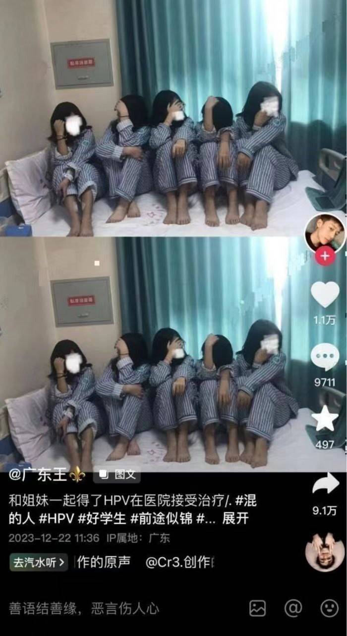 和姐妹一起得了HPV在医院接受治疗？？？？  