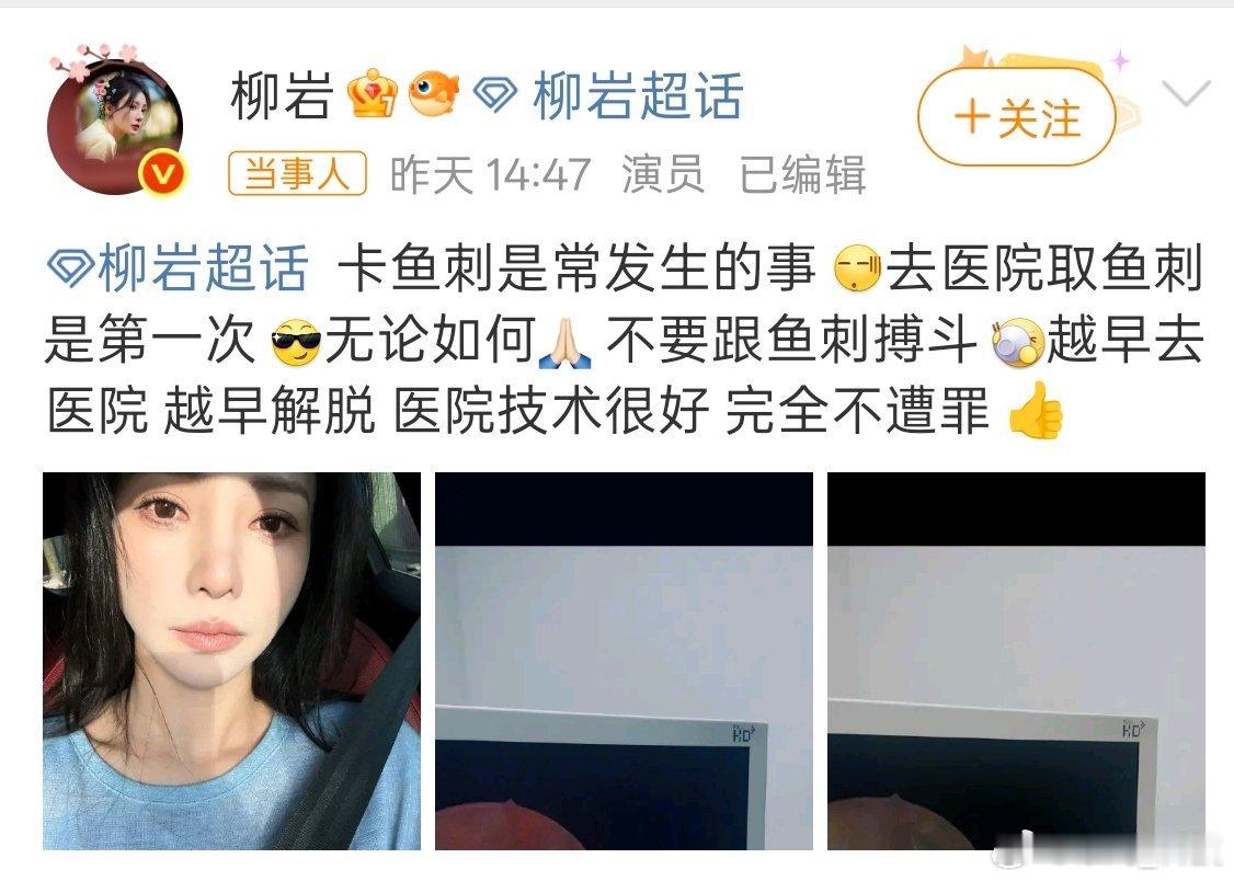 柳岩因卡鱼刺进了医院卡鱼刺确实很难受，遇到要及时就医。 ​​​