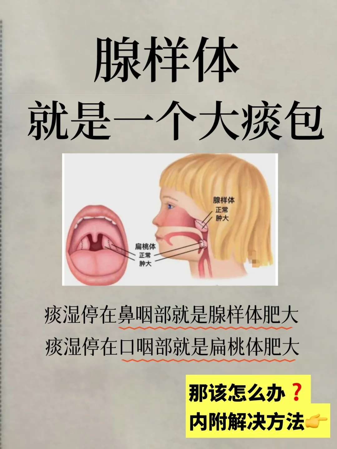 宝宝腺样体肥大不要急🔥手把手教你咋做❗