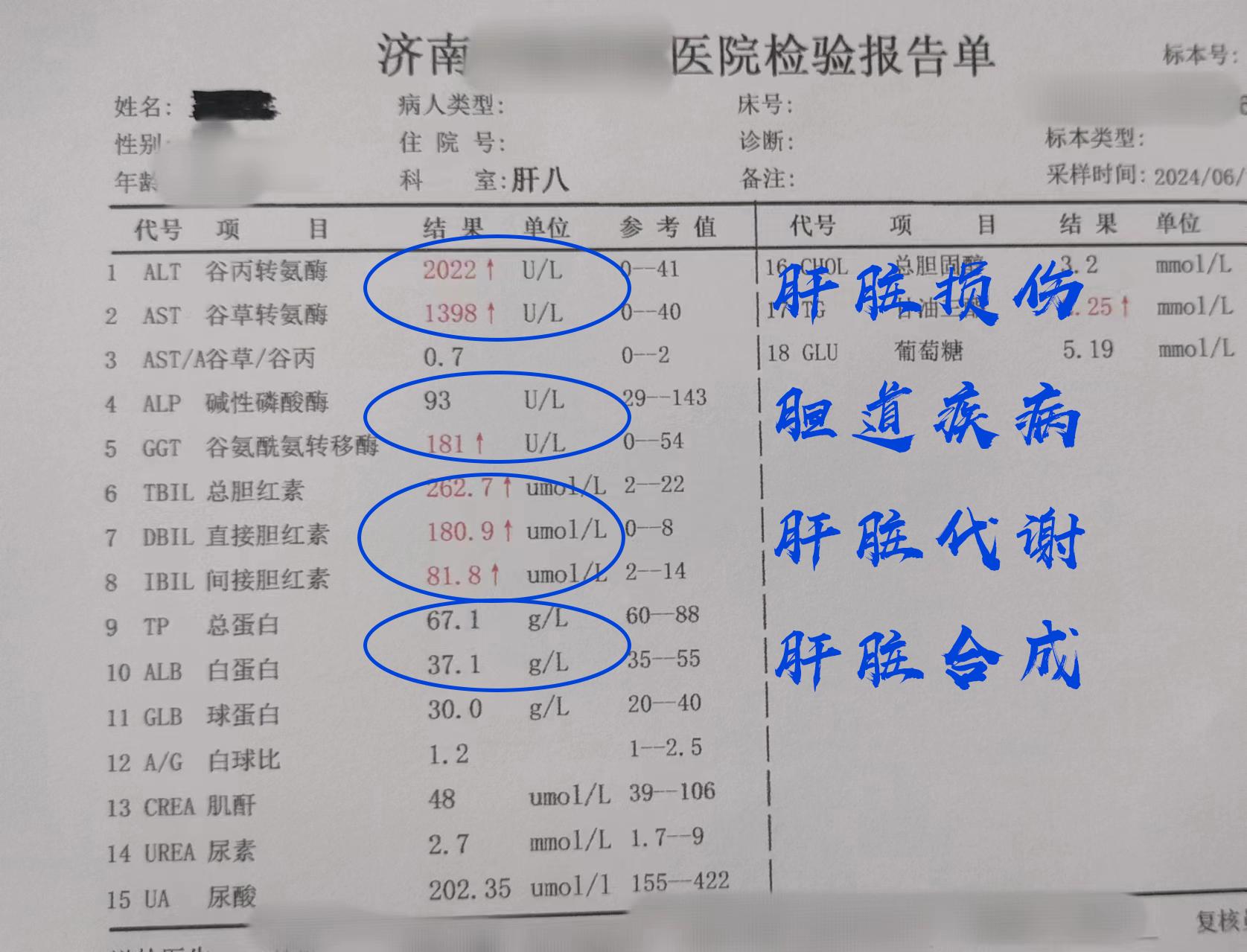肝功能这4项指标你都了解了吗？ 转氨酶：代表肝脏细胞的损伤情况 转肽酶...