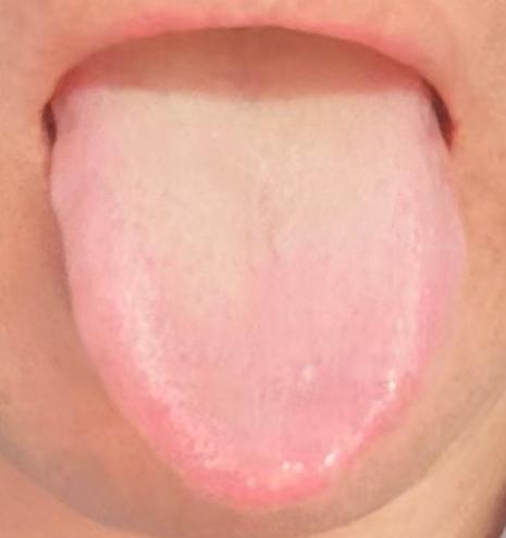 气血充盈，海绵体的状态自然会改善







前天有一个比较年轻的网友问我：为