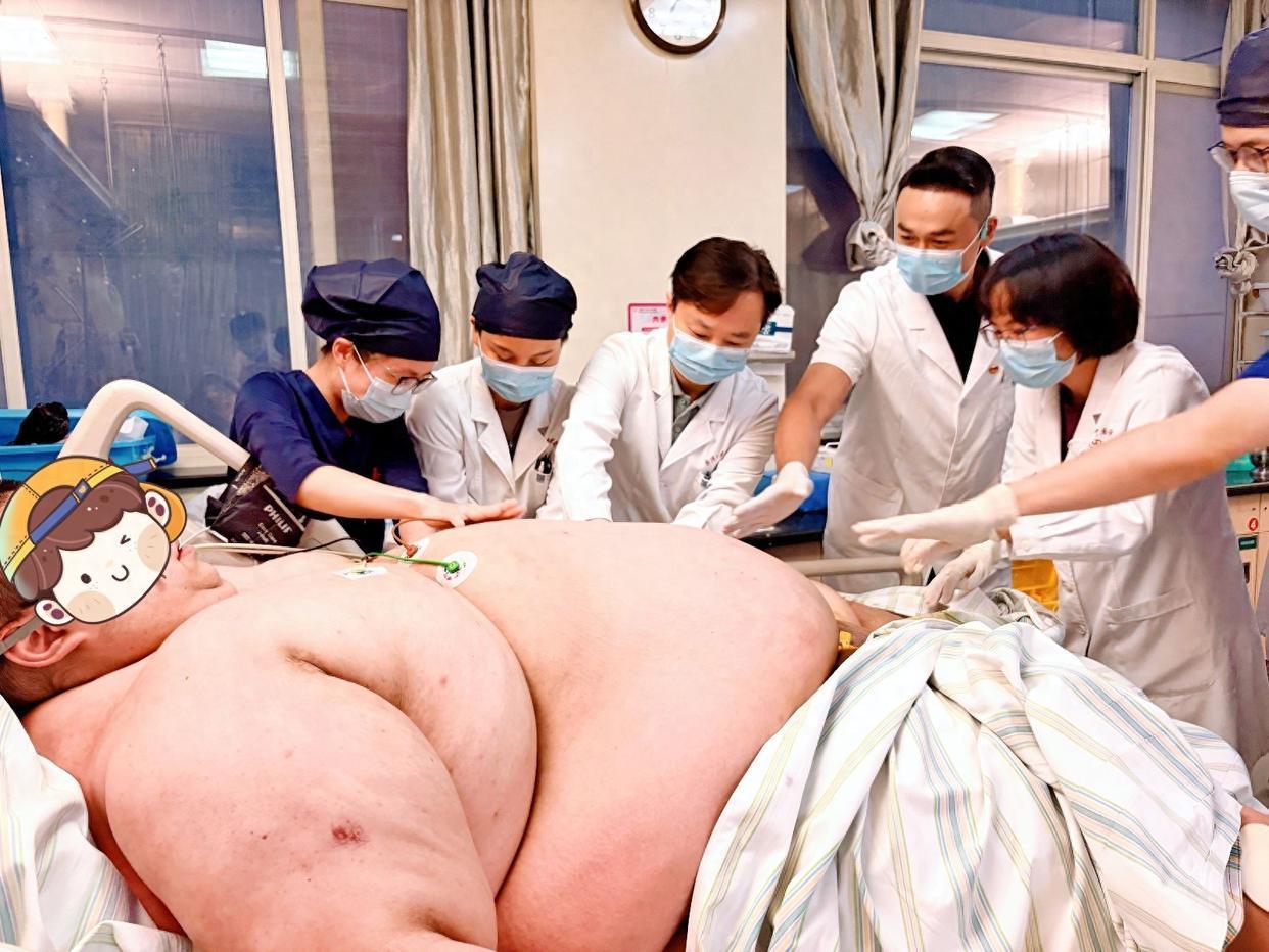 “目瞪口呆！”9月6日报道，一男子体重高达635斤，是全国第二重，他因为重度肥胖
