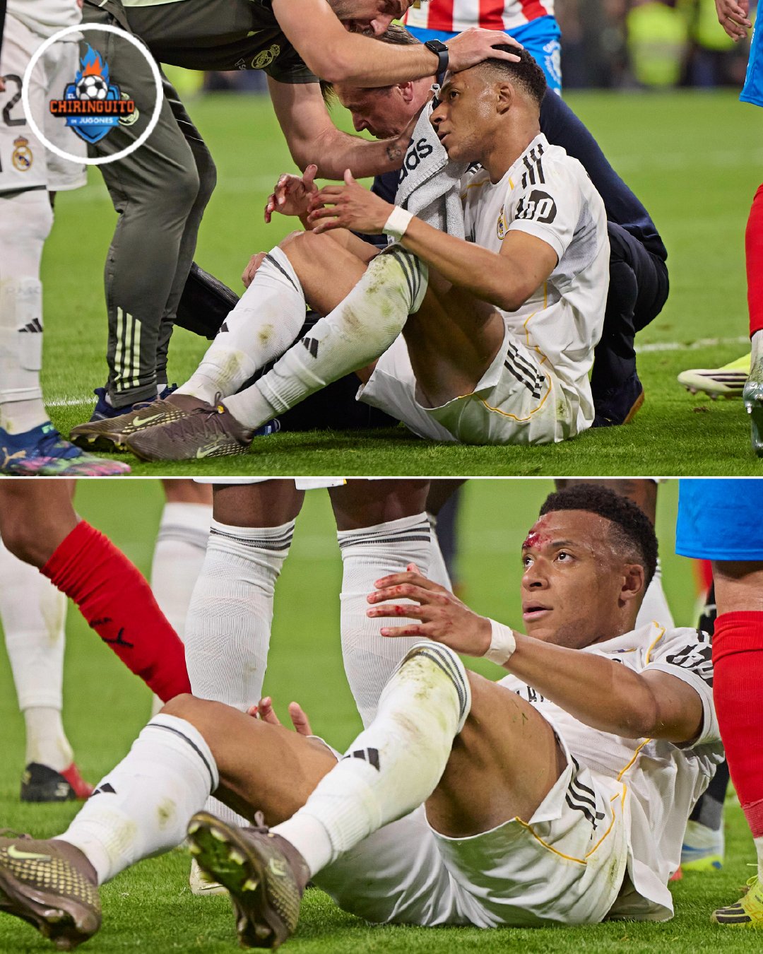 姆巴佩在禁区内头部已经被肘击出血，而且就在裁判的眼前。裁判认为没有问题，VAR也