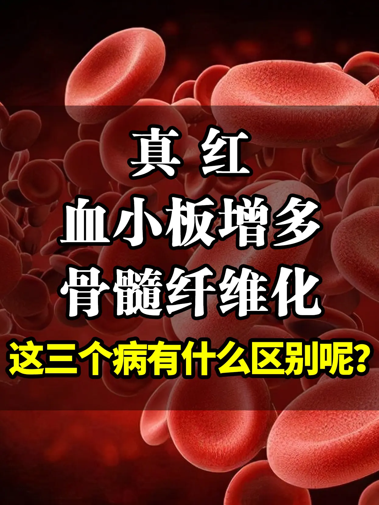 真红、血小板增多、骨髓纤维化，这三个病有什么区别呢？  大家好，我是血...