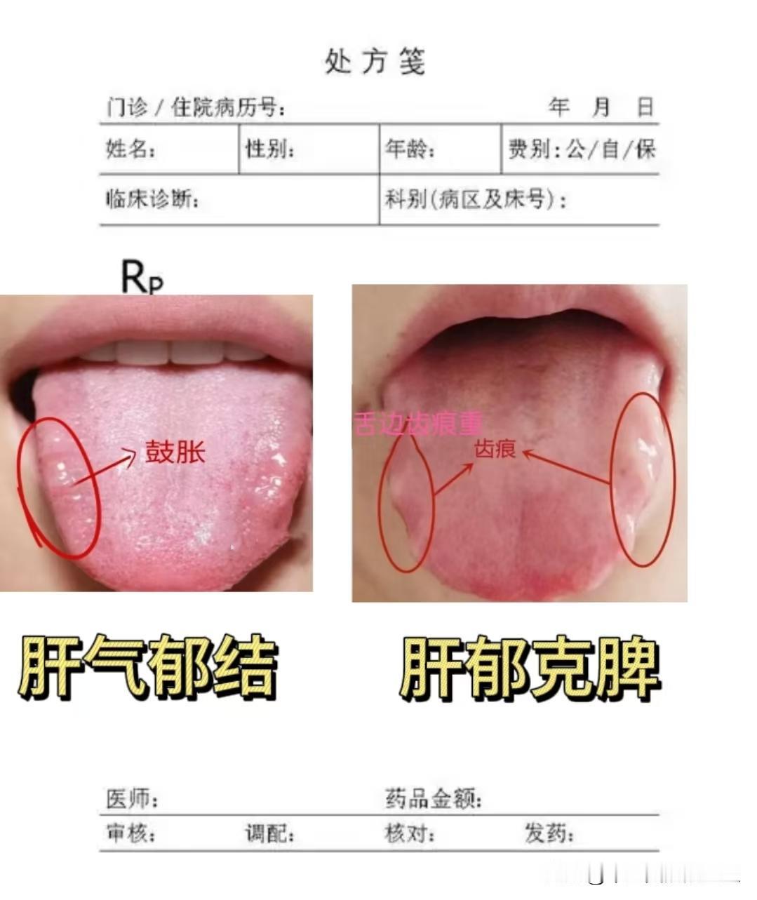 今日舌诊挑战！挑战看够50个舌头，还是老规矩，不要使用美颜！