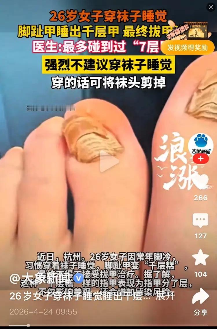 26岁女子穿袜子睡觉睡出千层甲这个提醒太及时啦！健康无小事，生活里的小习惯也藏着