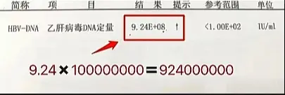 肝功能正常，病毒8次方，年龄29岁，是否需要抗病毒治疗！