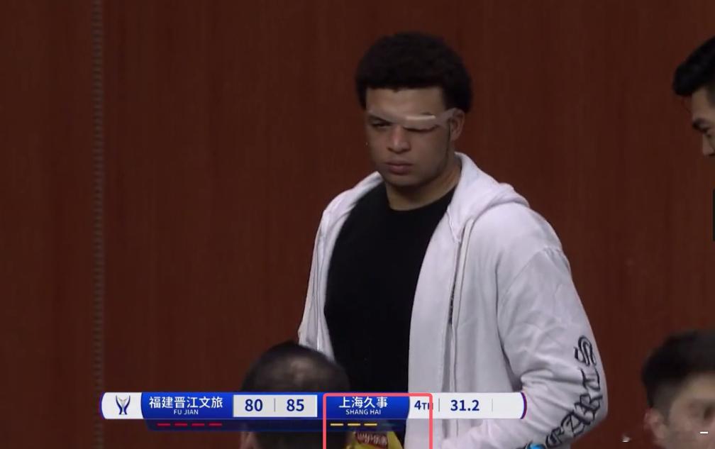 “小胖”洛夫顿眉角被呼了一巴掌，打裂了满是鲜血，然后包扎完手里多了一包薯片，哈哈