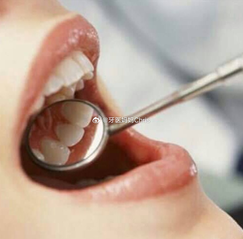 口腔健康牙齿松动很多人对牙齿松动的认知还停留在“老了自然会掉”的阶段。但实际上，