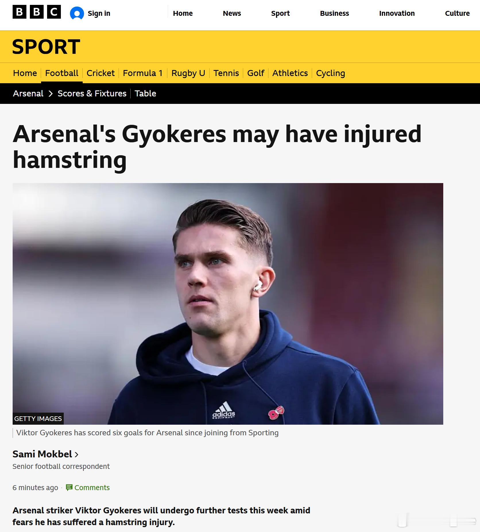 SamiMokbel：目前初步判断哲凯赖什至少缺阵两周，阿森纳本周还会对他做深入