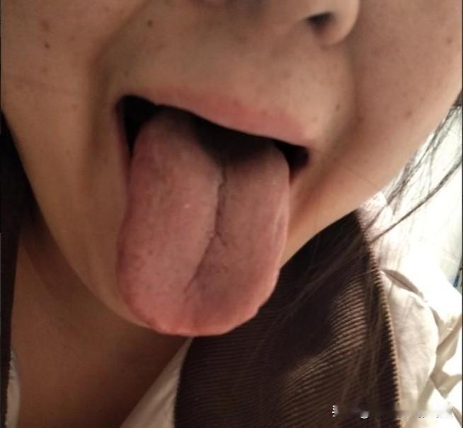 妹子，听姐一句劝，这气啊，就少生一点吧[吃瓜群众][吃瓜群众][吃瓜群众]
这妹