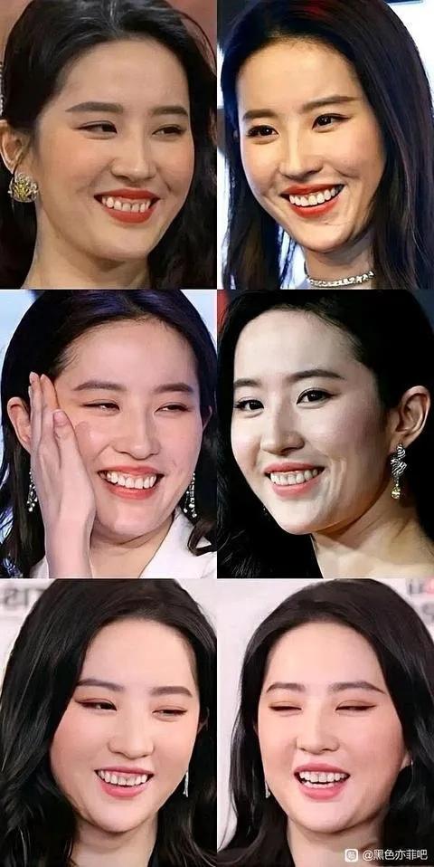 再美的人都有缺点，刘亦菲很美，只有大笑的时候，露出了牙床，有点不完美。