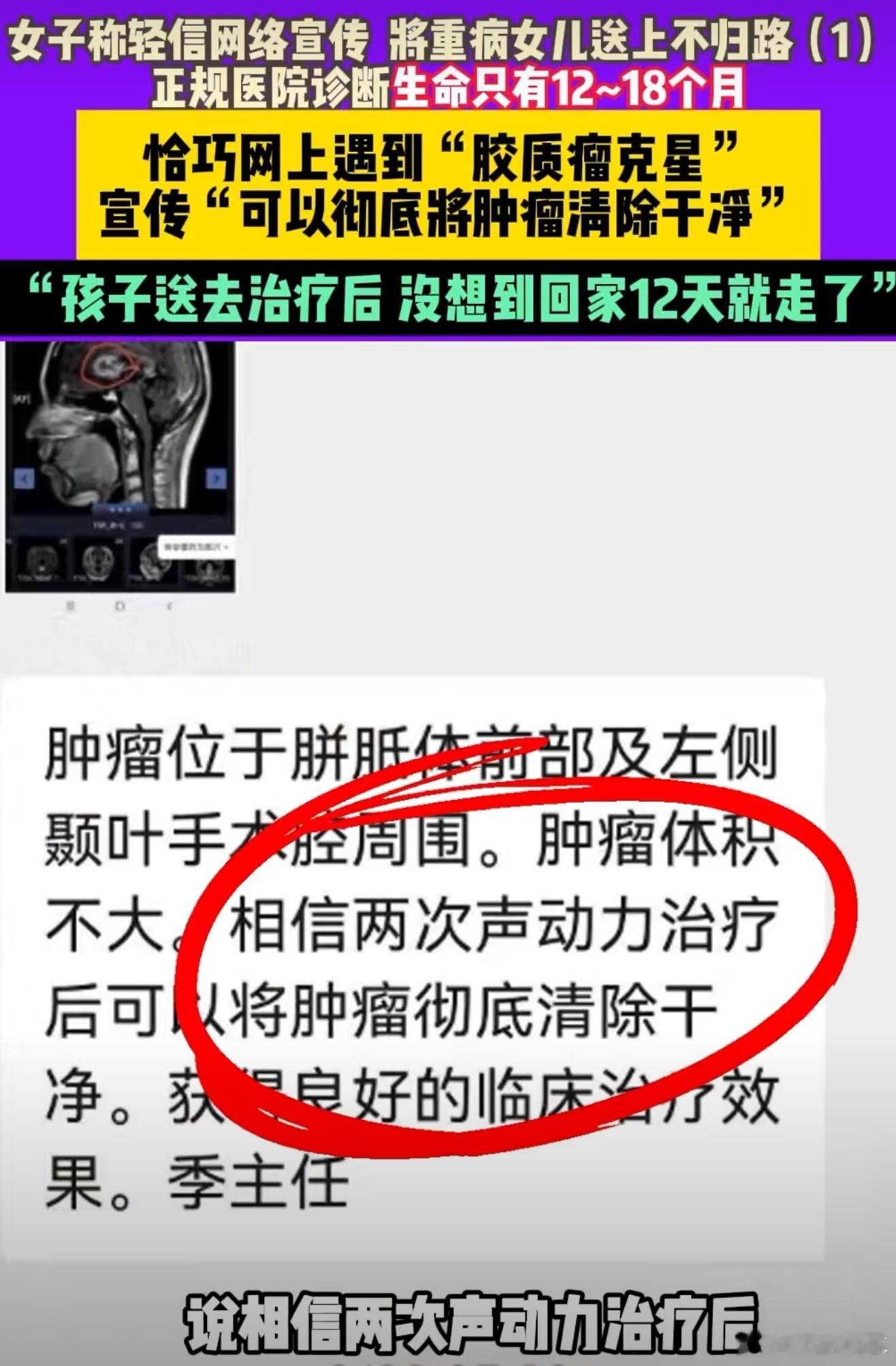 女孩经短视频引流治疗后12天去世无良机构太可恶了，利用病人家属救人心切的想法骗钱