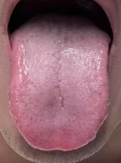 肾阳不足、湿气缠身？扶正祛邪，慢慢补足一身元气






很多人过往不节制，消