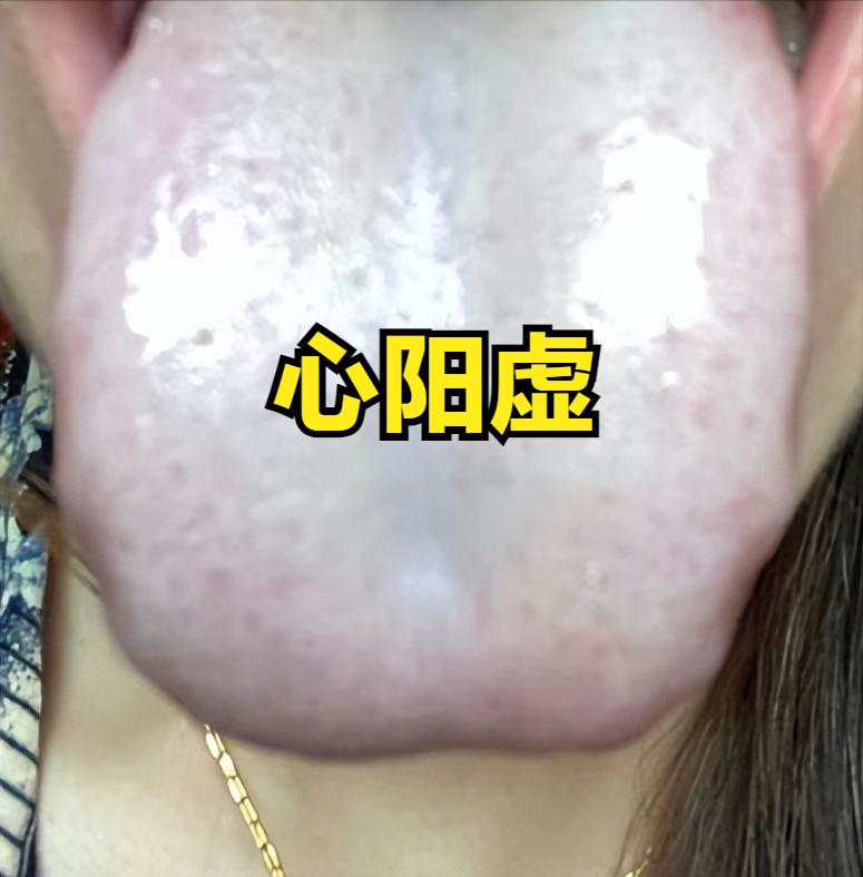 后背凉补心阳，肚子凉补脾阳，腰腿凉补肾阳，三个药，补足一身阳气
1.后背凉补心阳