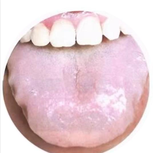 这 4 种体质！阳虚爱睡、阴虚失眠，血虚头晕、血瘀头痛

①阳虚--爱睡觉
表现