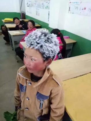 2018年，云南一名8岁男孩，顶着满头白发走进教室，引发哄堂大笑，老师上前察看，