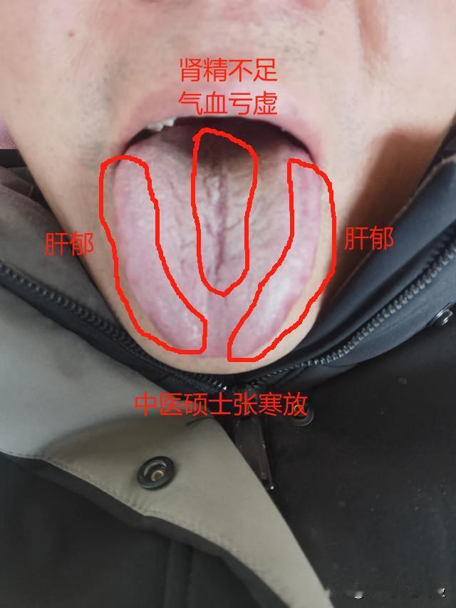 舌面上密密麻麻全是裂纹，遇上这样的舌头，我都头疼[晕][晕][晕]
粉丝上来就要