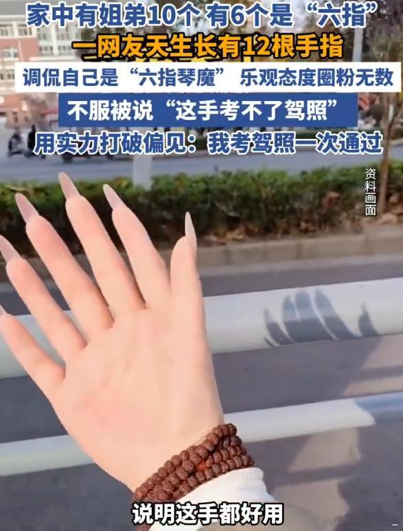 一家姐弟10个6个是六指 明知基因有问题...为什么父母还要生十个孩子？ 