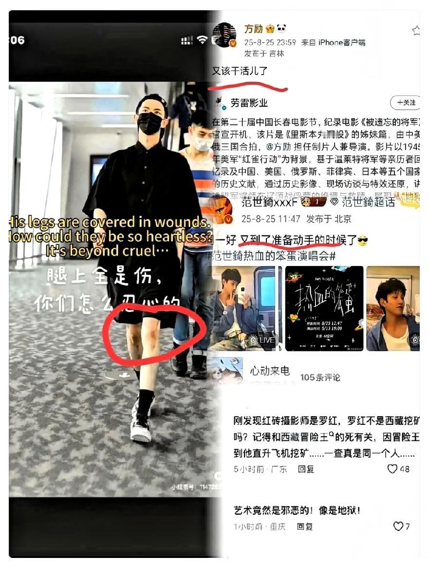反复放大那张照片，
腿上的淤青在屏幕里都感觉到很疼！

之前听说他口罩里塞纱布，