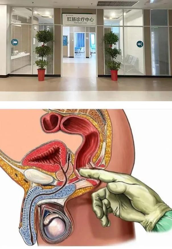 2020年12月的一天，深圳的陈女士（化名）因为血便怀疑自己得了痔疮，就预约了家