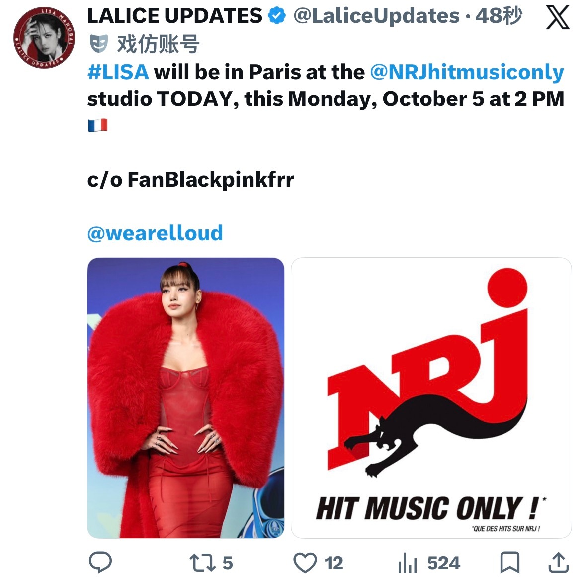 今天即将录制🇫🇷NRJ电台🗓️10.5 2PM（当地） ​​​