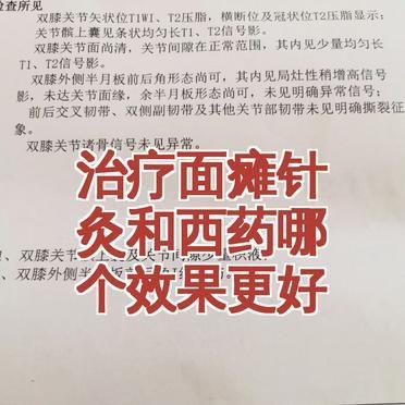 面瘫了，选针灸还是西药？
这问题问得就不对。
你真正该问的，是“我到底在哪个阶段