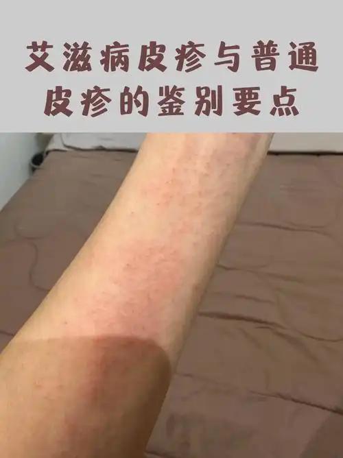 非洲艾滋病遍地成灾，为何还有这么多人能够存活？南非总统曾说：“艾滋病有啥可怕的，