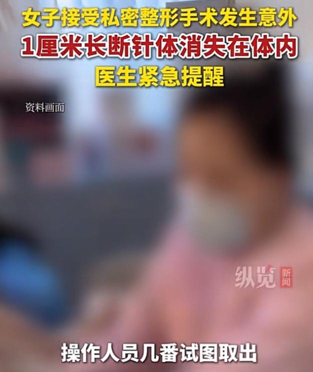 “替她捏了一把汗！”浙江，一女子生完孩子后，担心被丈夫嫌弃，于是，到一家私立美容