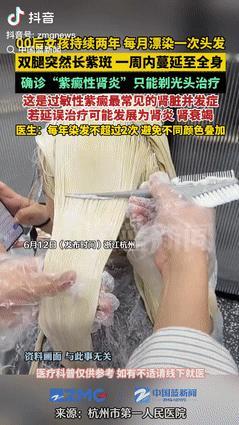代价太大了！6月12日，浙江杭州，一00后女孩热衷于染头发，基本上每个月都要染一