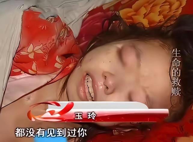 2008年，爷爷每天用镊子，从她背上的溃烂处一条条往外捏取蛆虫。十岁的蒋玉玲不流