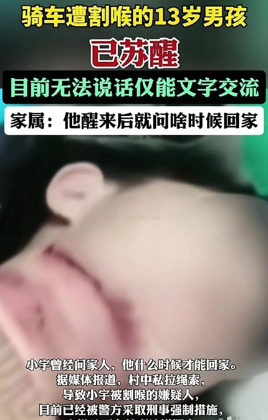 那个被私拉绳索割喉的13岁男孩终于醒了，醒来第一句话就问什么时候回家。

可他不