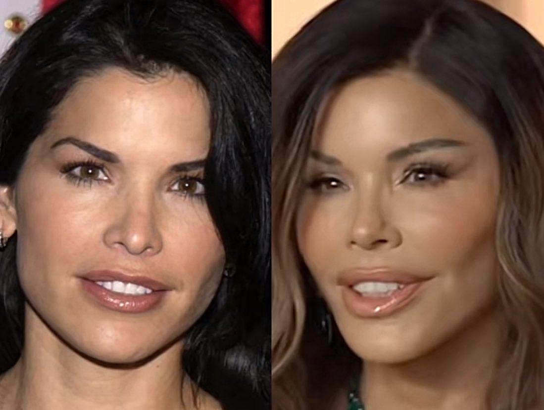 劳伦·桑切斯 (Lauren Sanchez) 前后对比照。

亿万富翁杰夫·贝