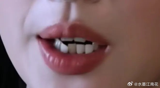 看牙猜女明星🌸 