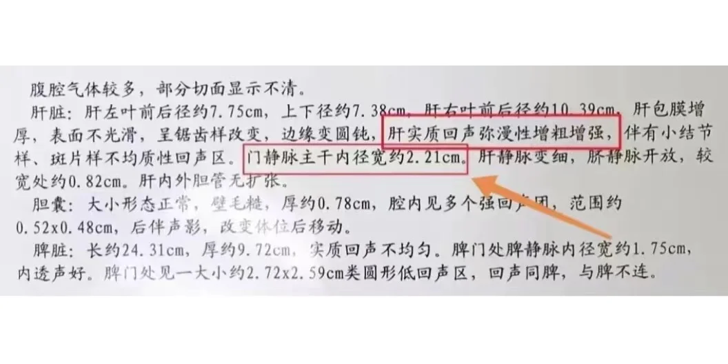 乙肝患者想要想远离肝硬化、肝癌，一定要控制好以下这4个指标 1、门静脉...