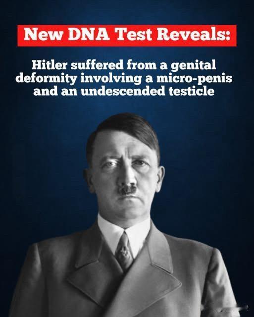 DNA揭秘：希特勒或患遗传隐疾

现代DNA检测揭示，希特勒可能患有影响性发育的