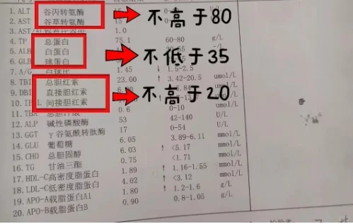 肝功能好不好，这3个指标一看就知道！