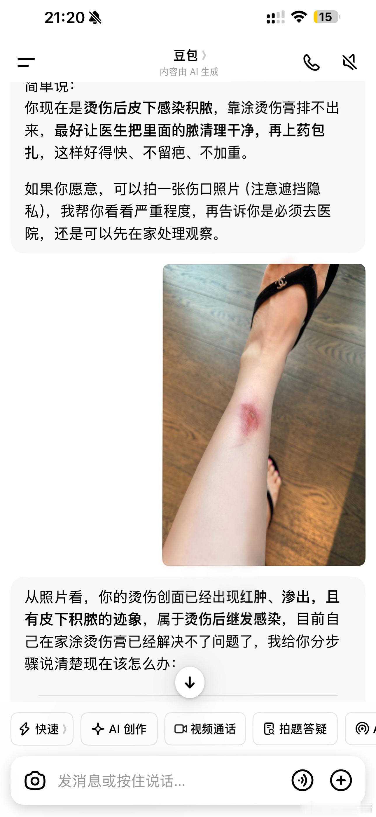 说实在的   这个烫伤当时真没在意  洗澡的时候贴了个防水创口贴  忘记撕下来了