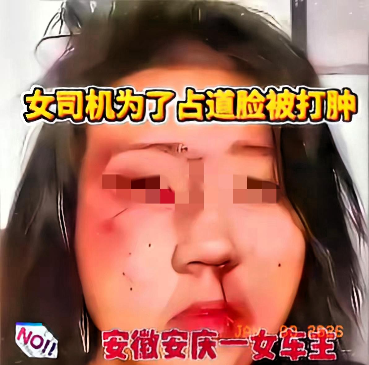 国道被龟速车堵了10公里，前车大姐开28码还热火朝天地打视频，完全不管后车喇叭震