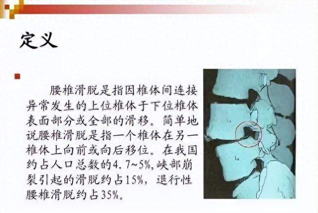 陈赫自曝旧伤复发，给所有人提了个醒