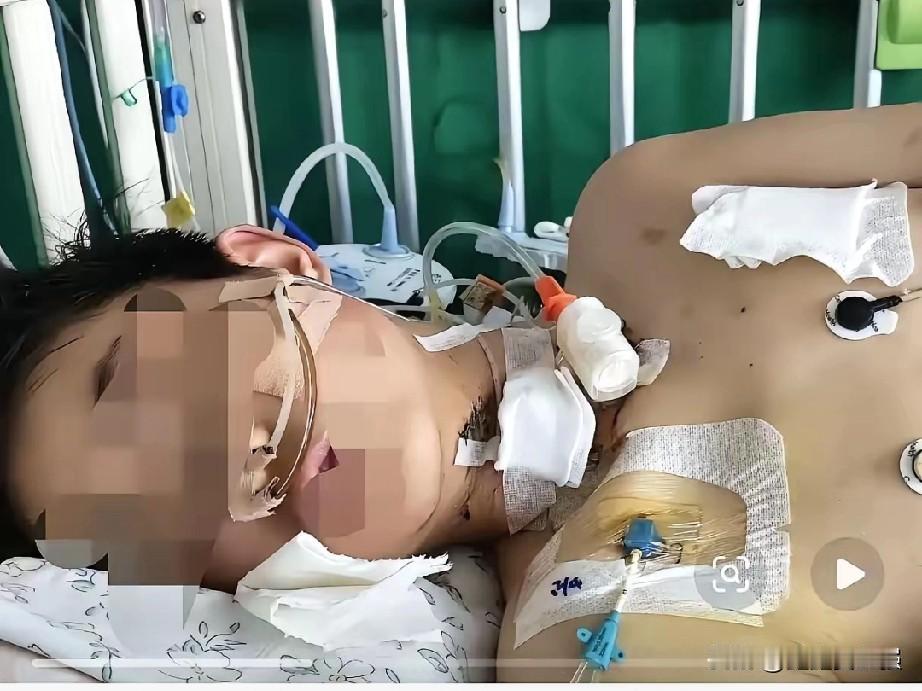 太好了，他活下来了。
大难不死，必有后福，感谢各路好心人出手相救， 上天保佑啊。