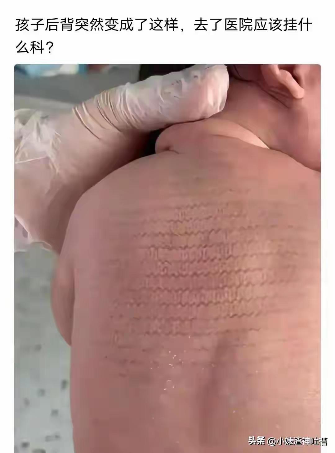 这让花开富贵看到了，你的脸得挂皮肤科