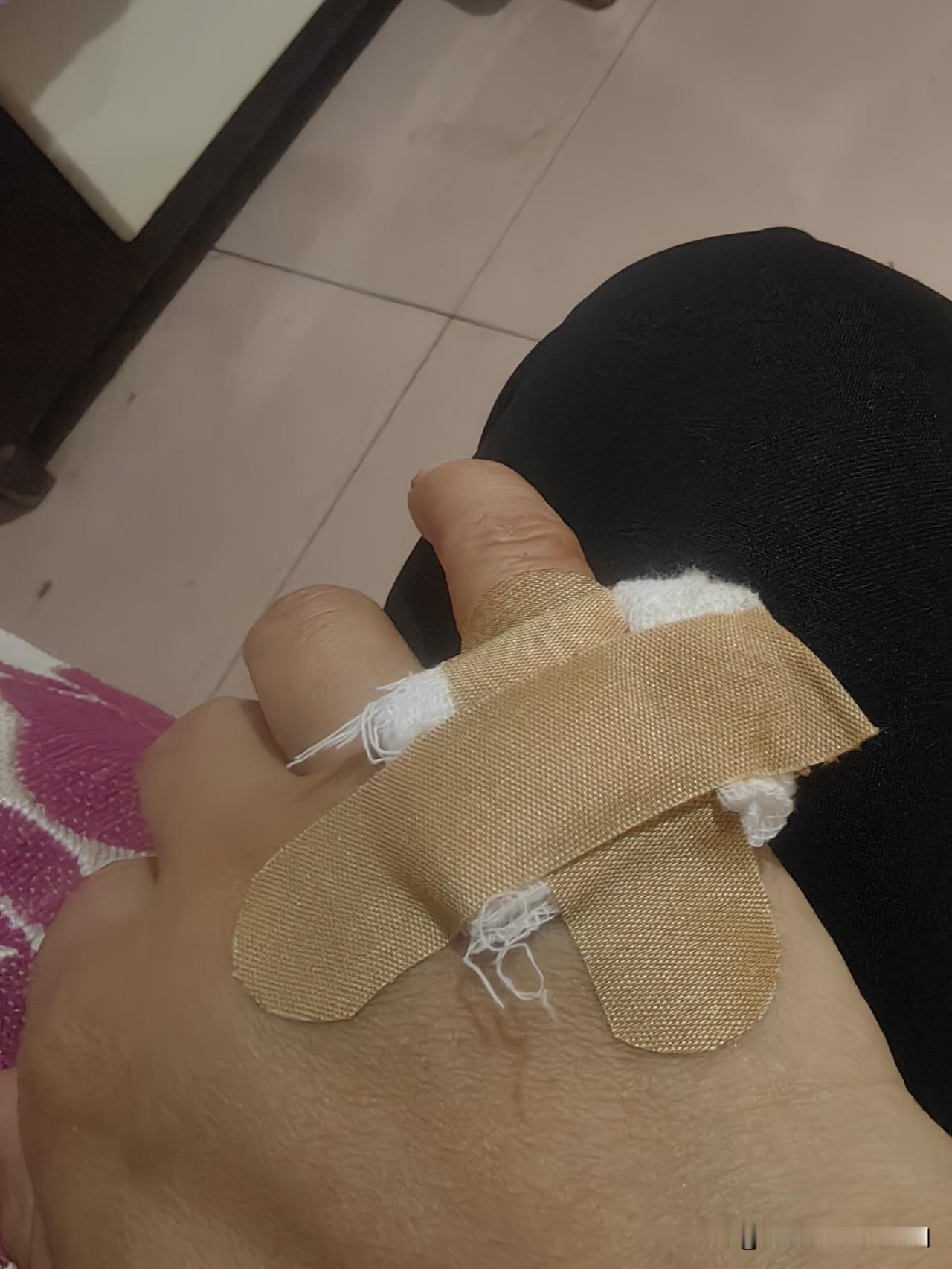 昨天干活时我不小心把手割破了，也肿了，闺女说妈妈你手不能沾水今天我给做饭洗碗，我