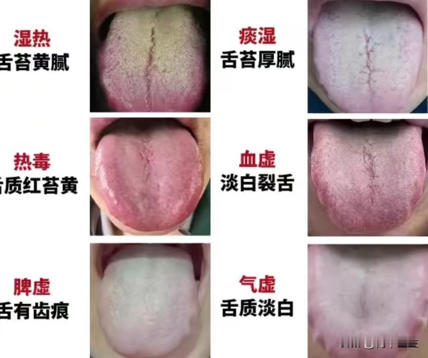 假期结束第一天，继续公益舌诊中！你伸舌头我来分析，1分钟告知病因和调理方向！只要