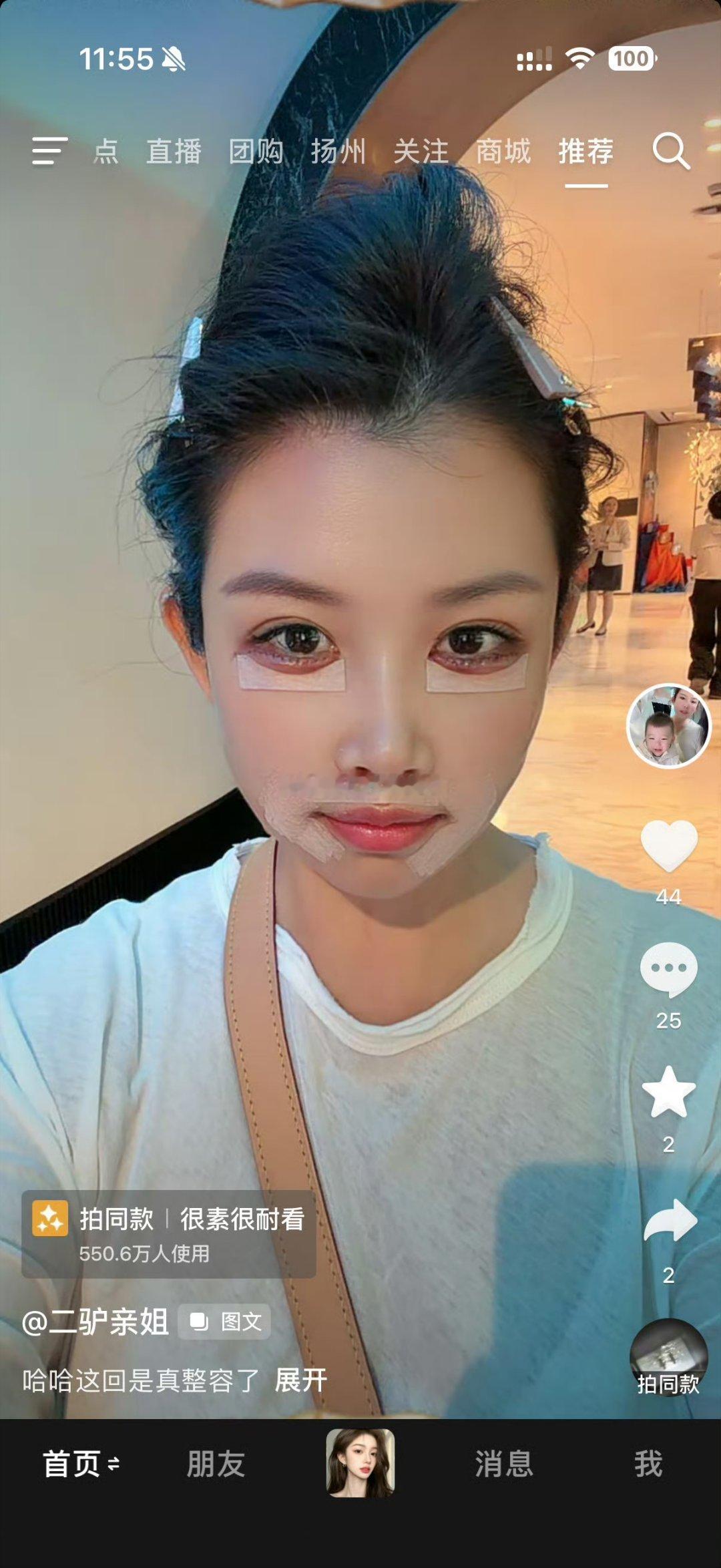 怎么不去驴家阿东那里？去上海了🤣网红推荐医美靠谱吗 ​​​