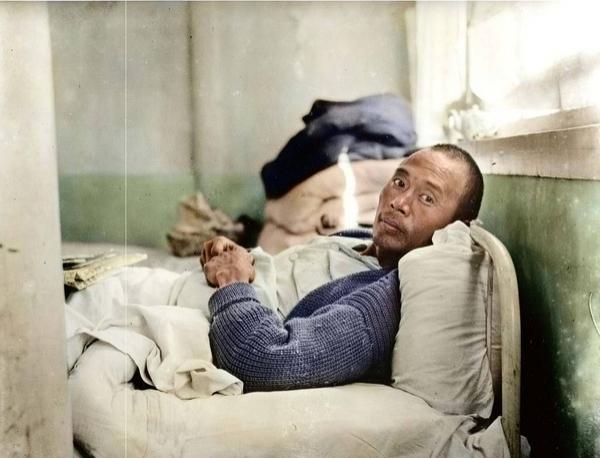 照片中躺在病床上的男人叫李曾志，绰号“李跛子”。1933年率领大刀队在喜峰口一战